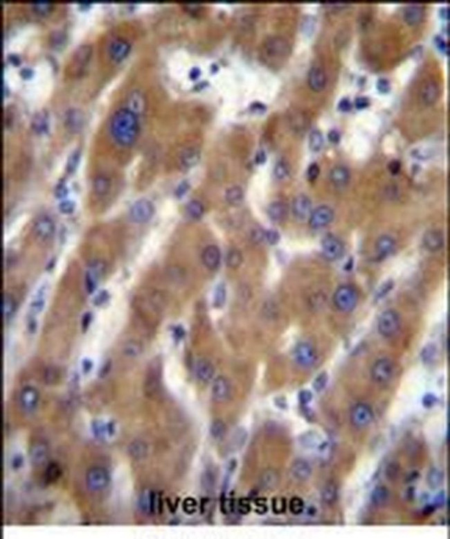 UBAP2 Antibody in Immunohistochemistry (Paraffin) (IHC (P))