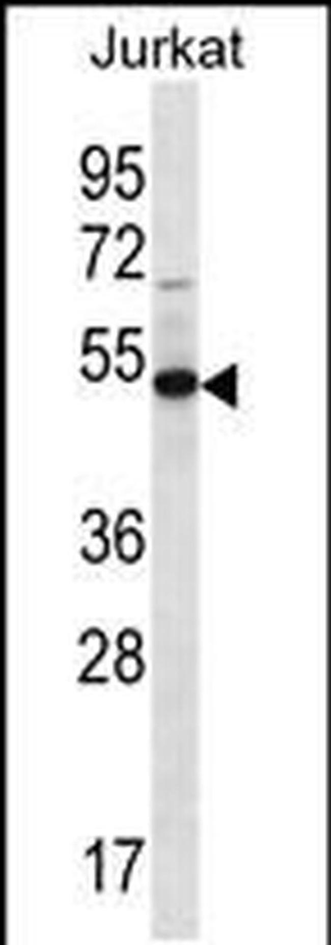 FAM8A1 Antibody in Western Blot (WB)