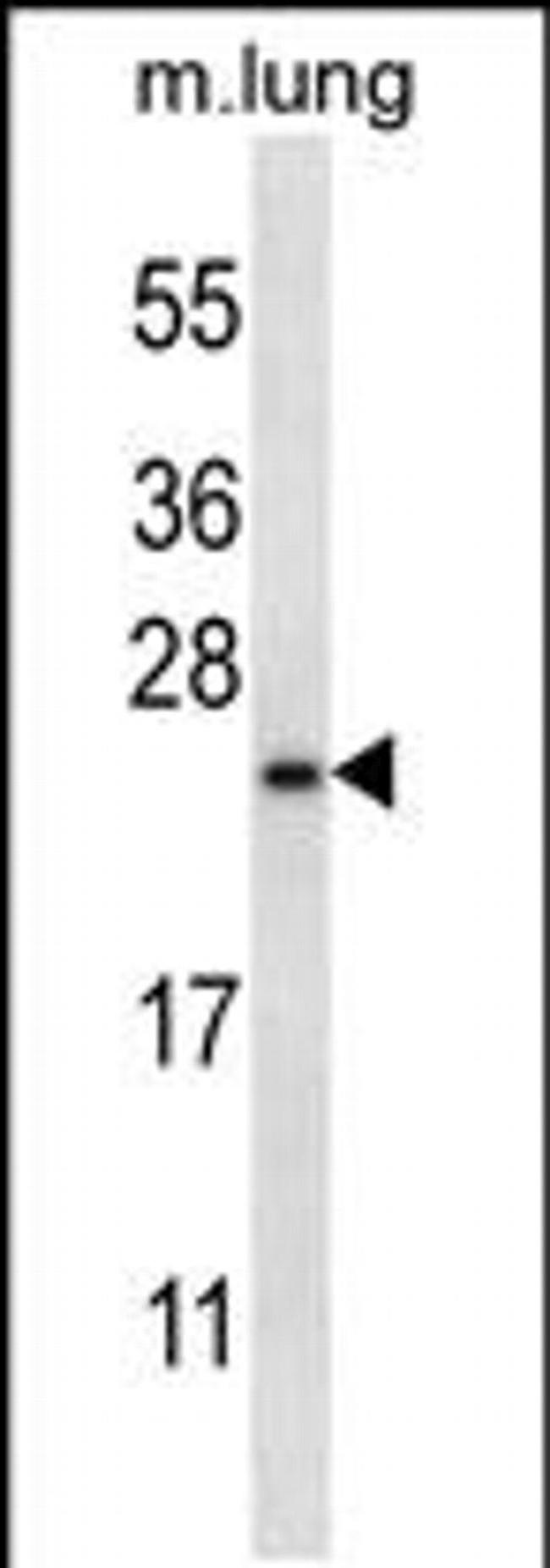 RHEBL1 Antibody in Western Blot (WB)
