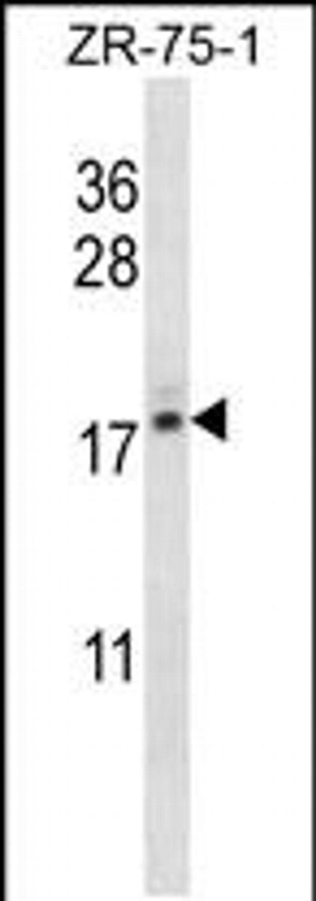 TNP2 Antibody in Western Blot (WB)