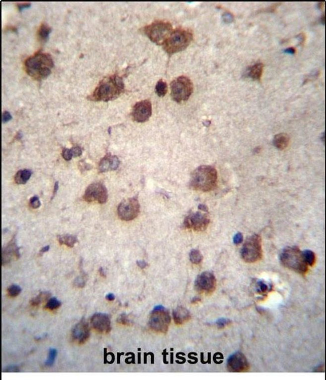 PHAX Antibody in Immunohistochemistry (Paraffin) (IHC (P))