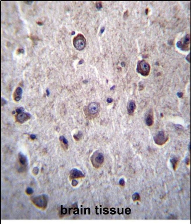 DOC2A Antibody in Immunohistochemistry (Paraffin) (IHC (P))