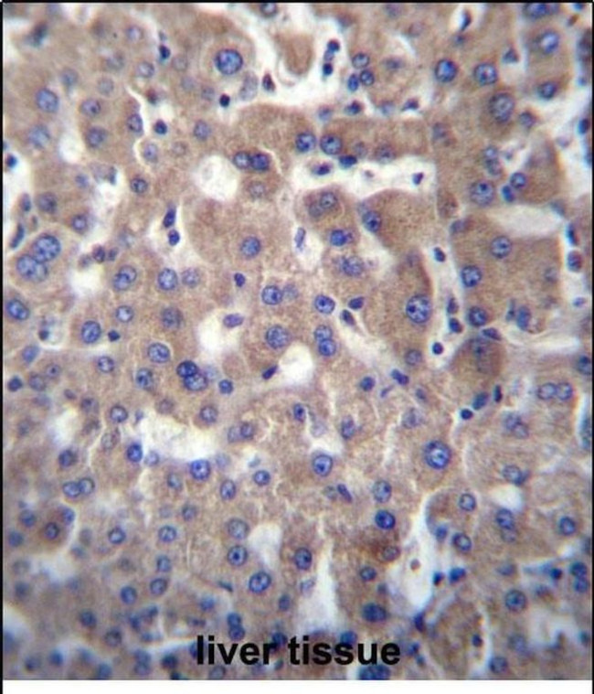 GGT2 Antibody in Immunohistochemistry (Paraffin) (IHC (P))