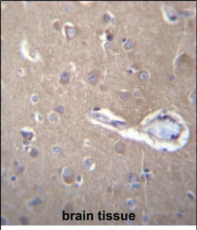 SEC62 Antibody in Immunohistochemistry (Paraffin) (IHC (P))