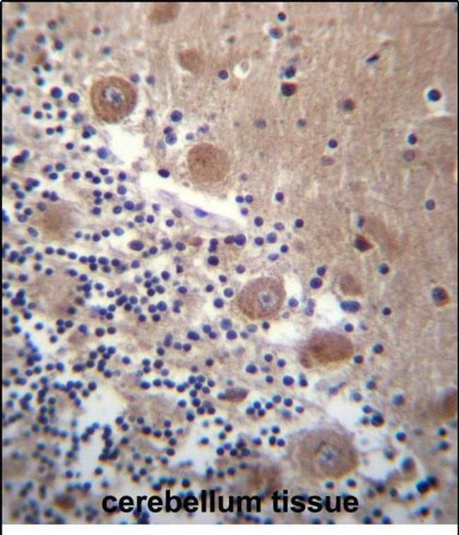 SCHIP1 Antibody in Immunohistochemistry (Paraffin) (IHC (P))
