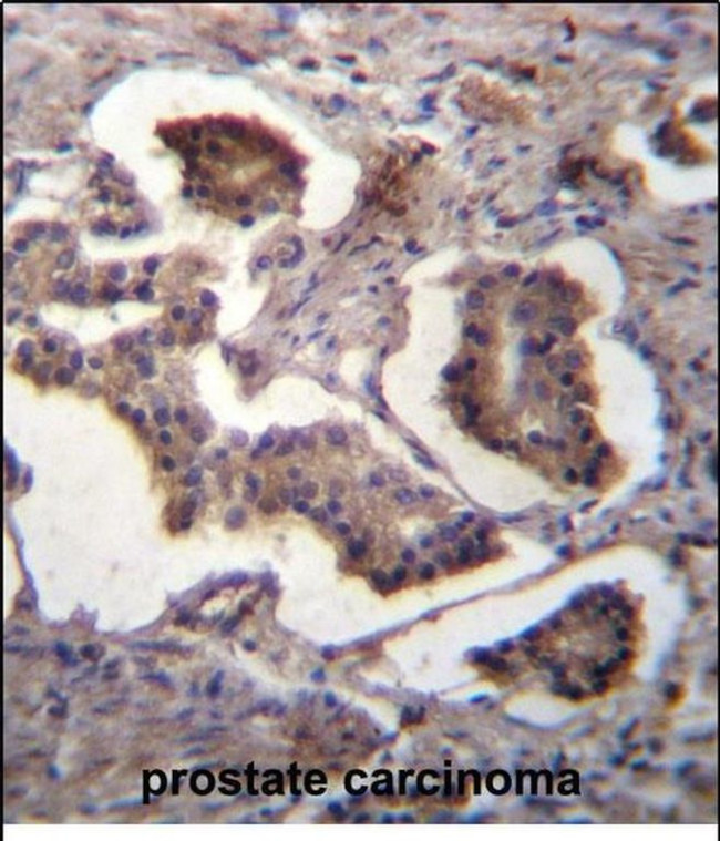 GUF1 Antibody in Immunohistochemistry (Paraffin) (IHC (P))
