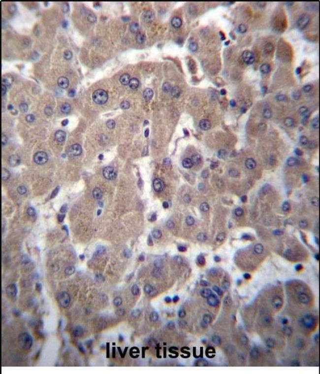 YIPF1 Antibody in Immunohistochemistry (Paraffin) (IHC (P))