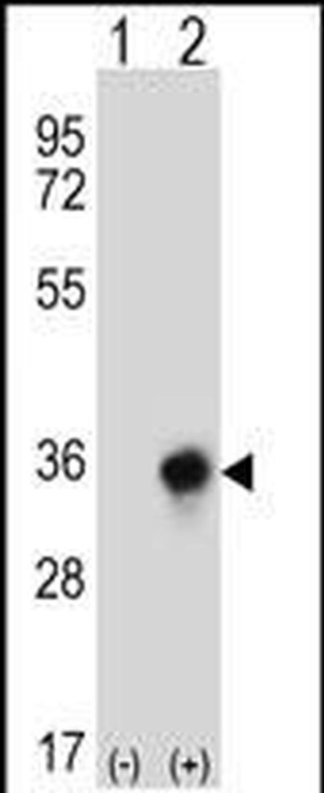 CBR3 Antibody in Western Blot (WB)