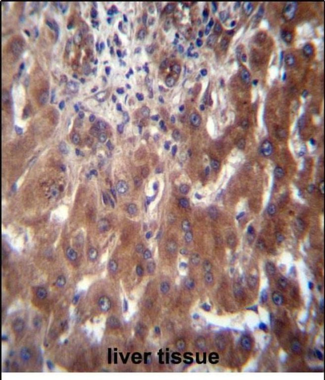SCLT1 Antibody in Immunohistochemistry (Paraffin) (IHC (P))