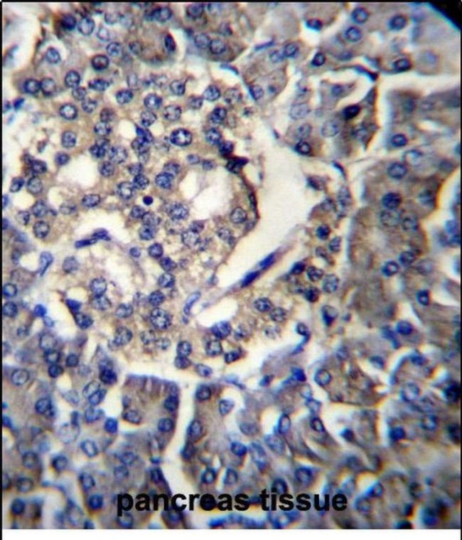 RPL35 Antibody in Immunohistochemistry (Paraffin) (IHC (P))
