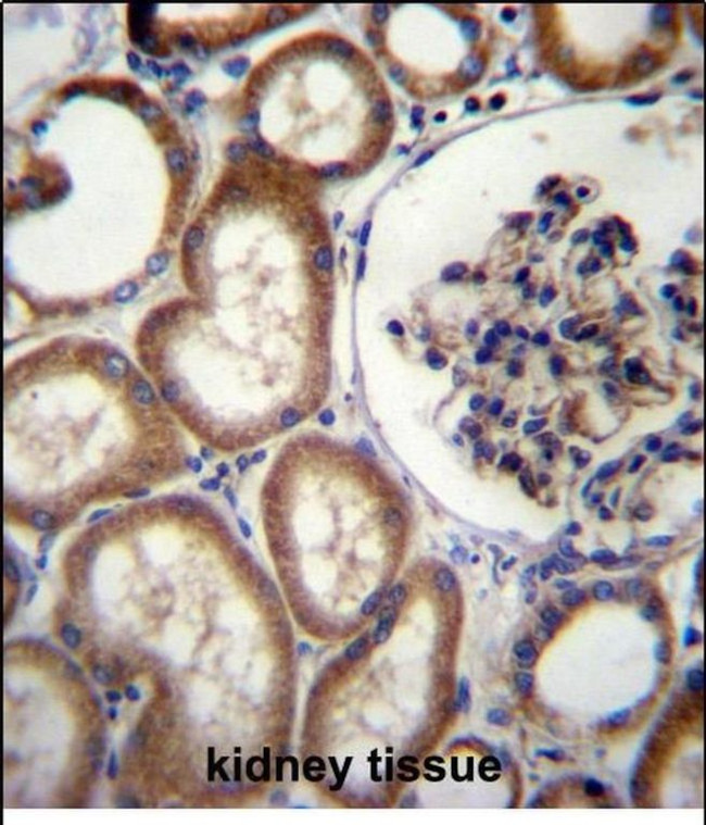 MBTPS2 Antibody in Immunohistochemistry (Paraffin) (IHC (P))