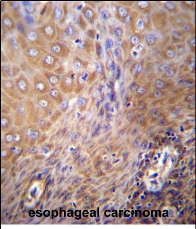 SLC6A14 Antibody in Immunohistochemistry (Paraffin) (IHC (P))