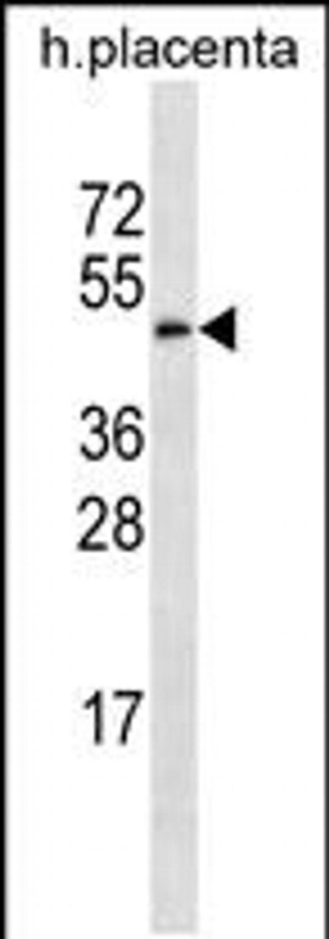GAL3ST4 Antibody in Western Blot (WB)