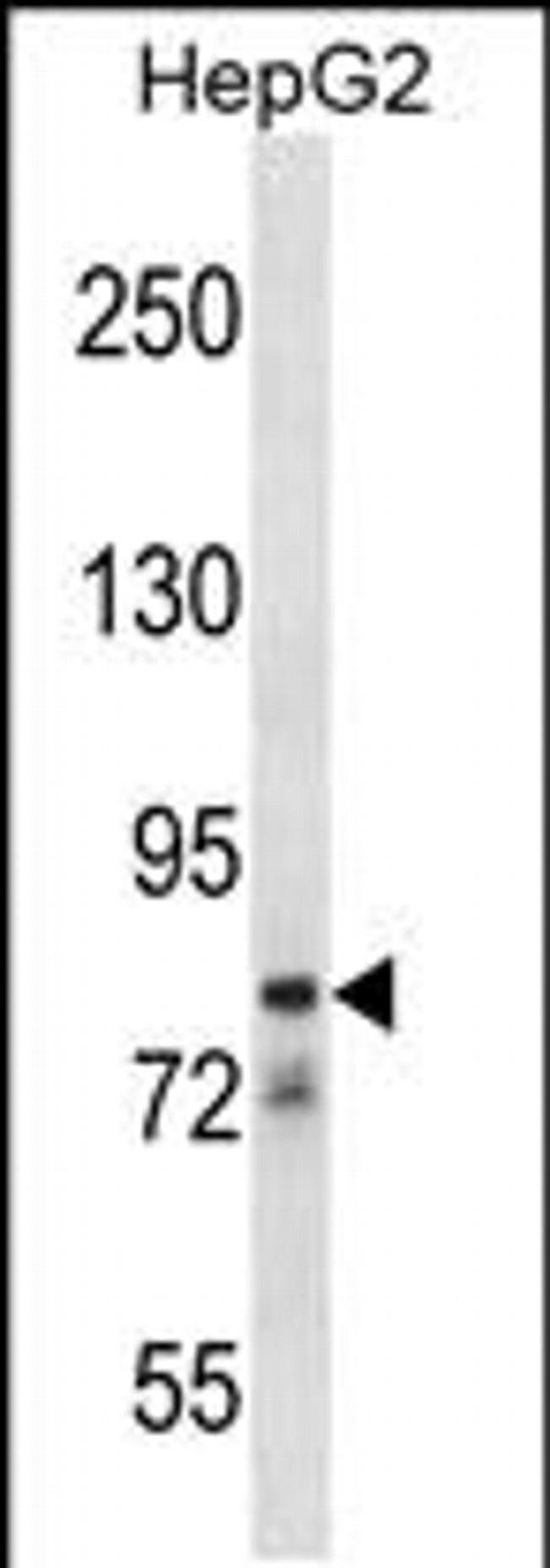CATSPER1 Antibody in Western Blot (WB)