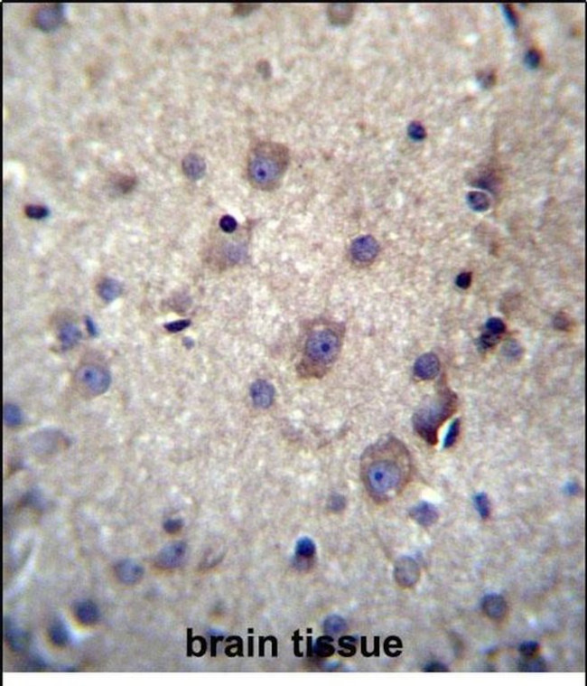 HBQ1 Antibody in Immunohistochemistry (Paraffin) (IHC (P))