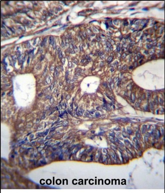 UQCRB Antibody in Immunohistochemistry (Paraffin) (IHC (P))