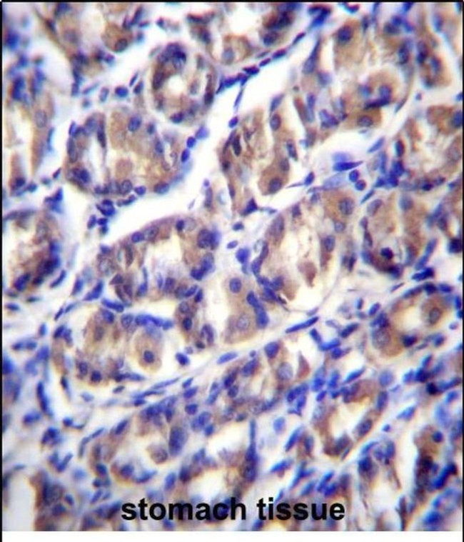 ODF2L Antibody in Immunohistochemistry (Paraffin) (IHC (P))