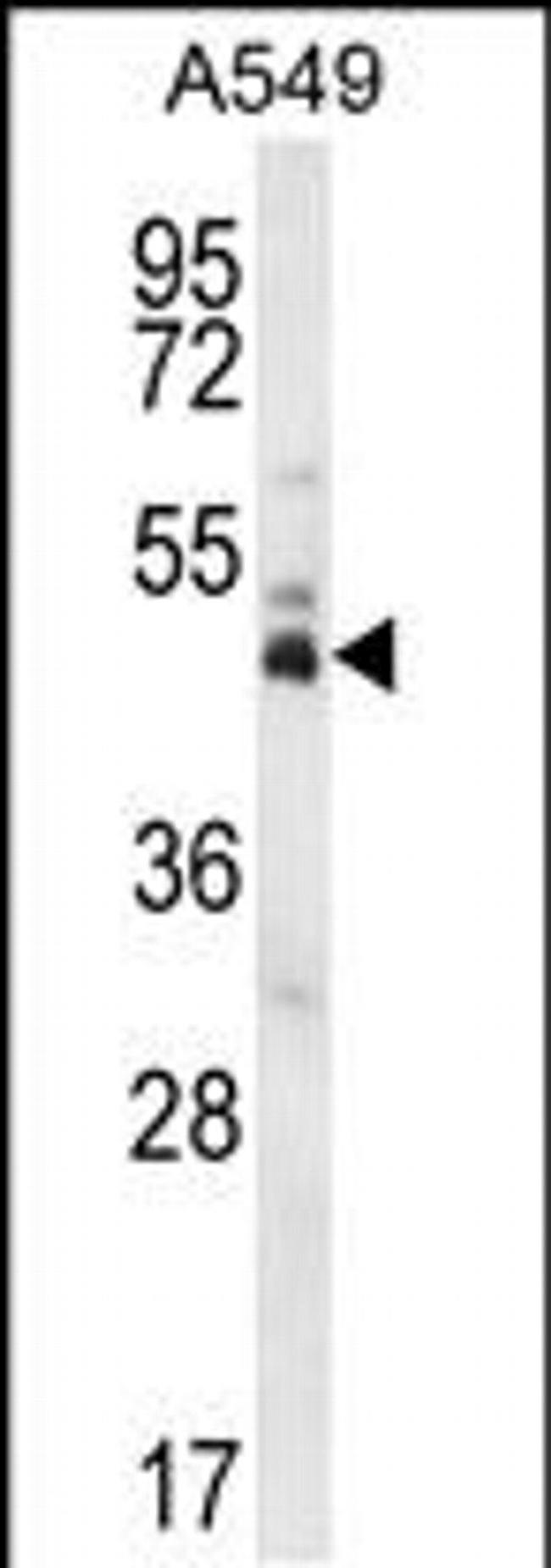 DUX4 Antibody in Western Blot (WB)