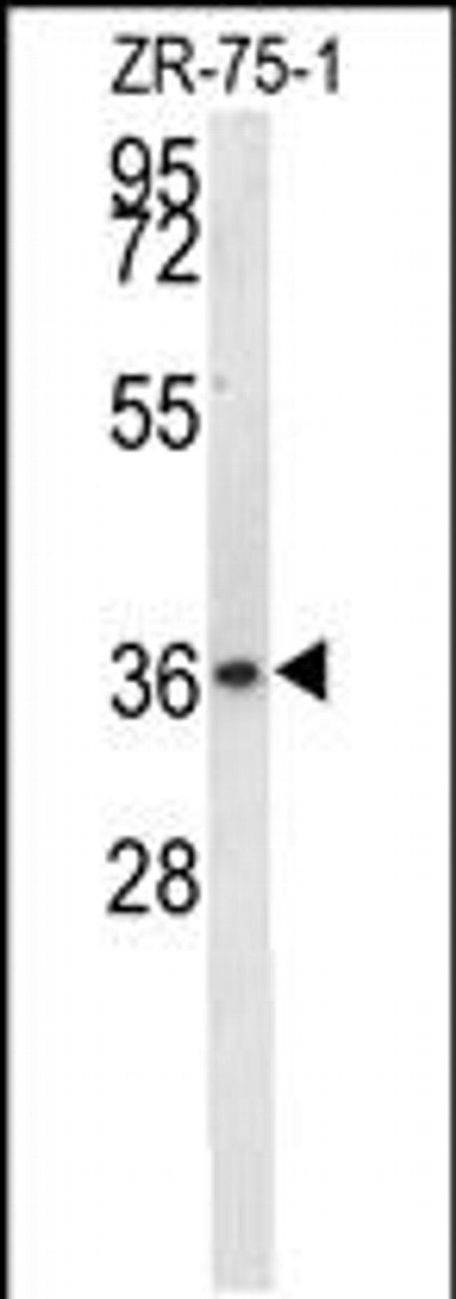 NIT1 Antibody in Western Blot (WB)