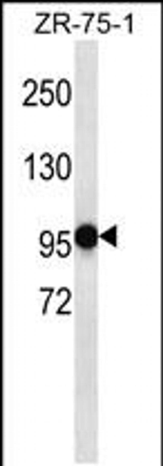 PHF14 Antibody in Western Blot (WB)