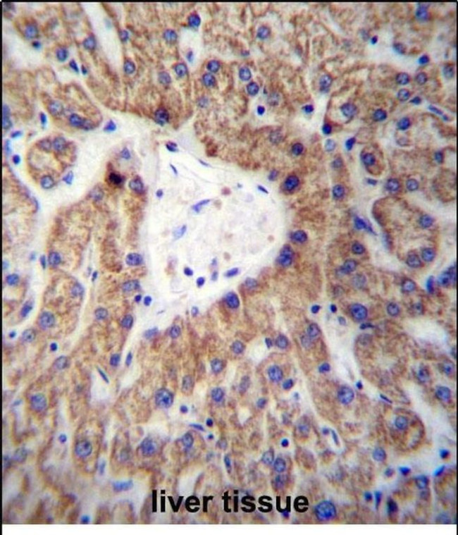 GLYAT Antibody in Immunohistochemistry (Paraffin) (IHC (P))