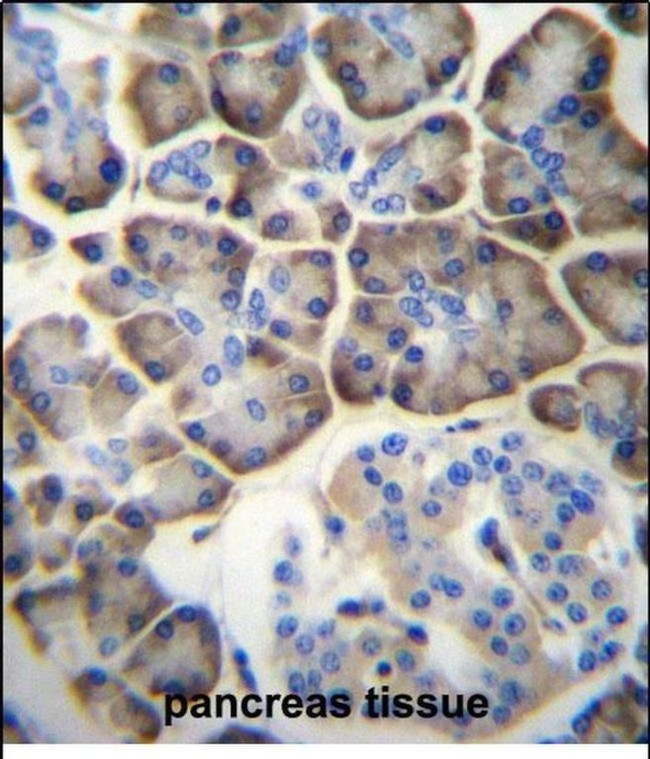 KCNV2 Antibody in Immunohistochemistry (Paraffin) (IHC (P))