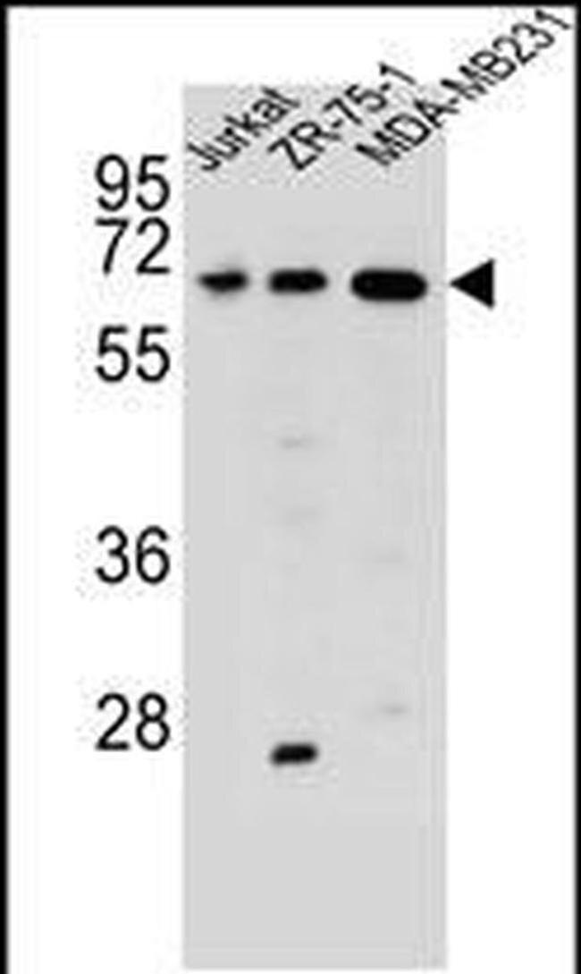 ZSCAN2 Antibody in Western Blot (WB)