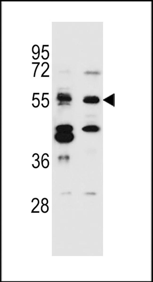 TNRC4 Antibody in Western Blot (WB)