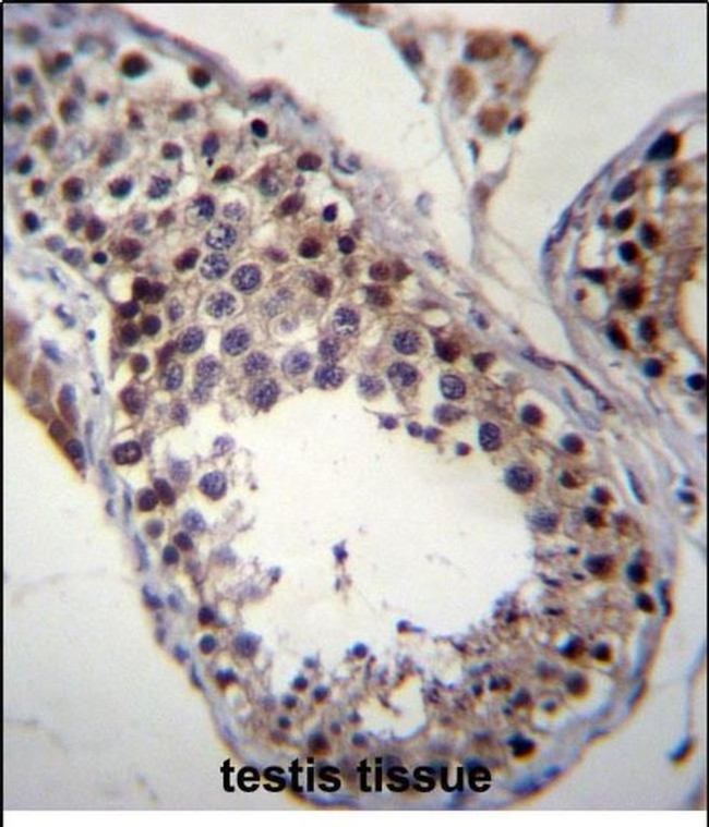 SPATA19 Antibody in Immunohistochemistry (Paraffin) (IHC (P))