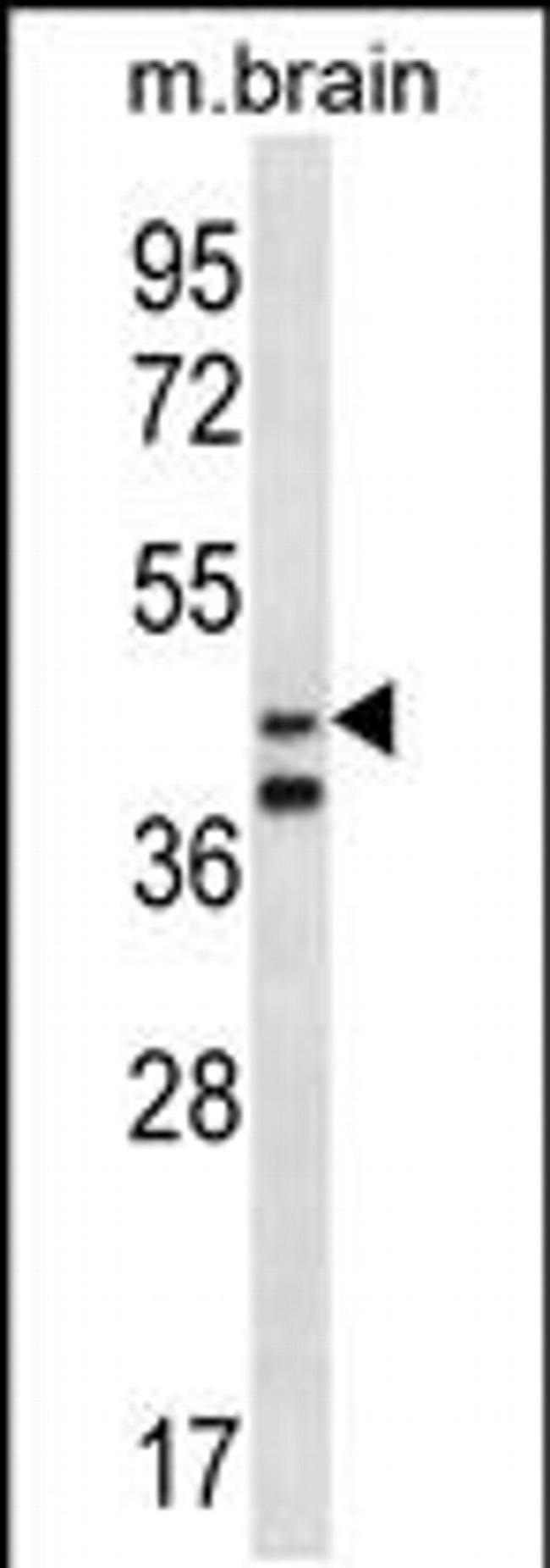 ORC5L Antibody in Western Blot (WB)