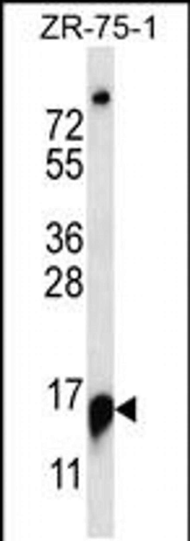 RPP25 Antibody in Western Blot (WB)