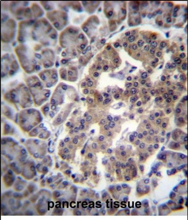 DNAJC14 Antibody in Immunohistochemistry (Paraffin) (IHC (P))