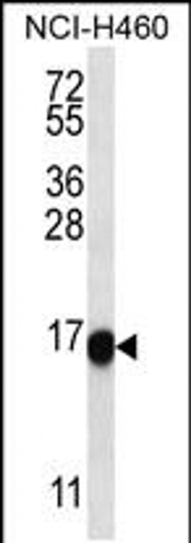 SLITRK2 Antibody in Western Blot (WB)