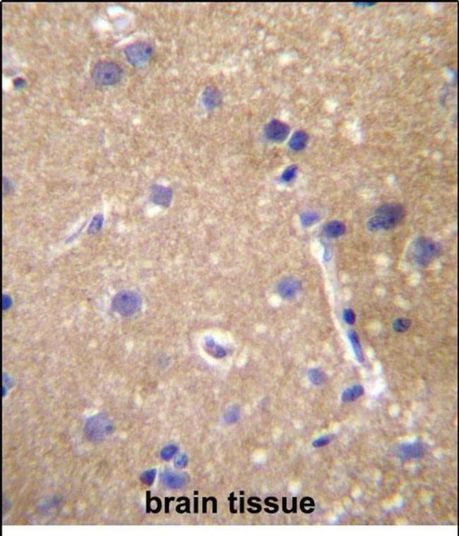MRP9 Antibody in Immunohistochemistry (Paraffin) (IHC (P))