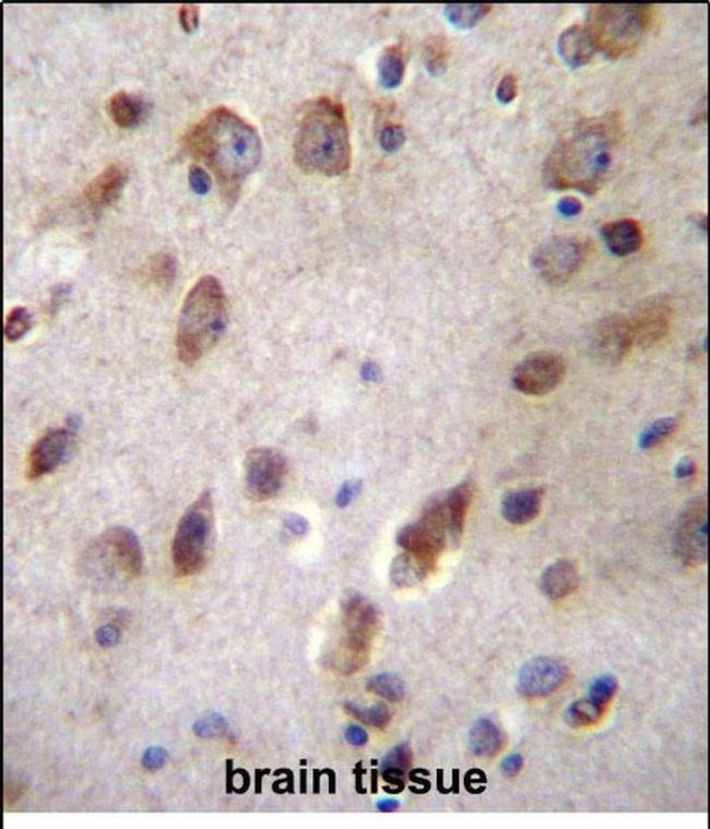 B3GNT1 Antibody in Immunohistochemistry (Paraffin) (IHC (P))