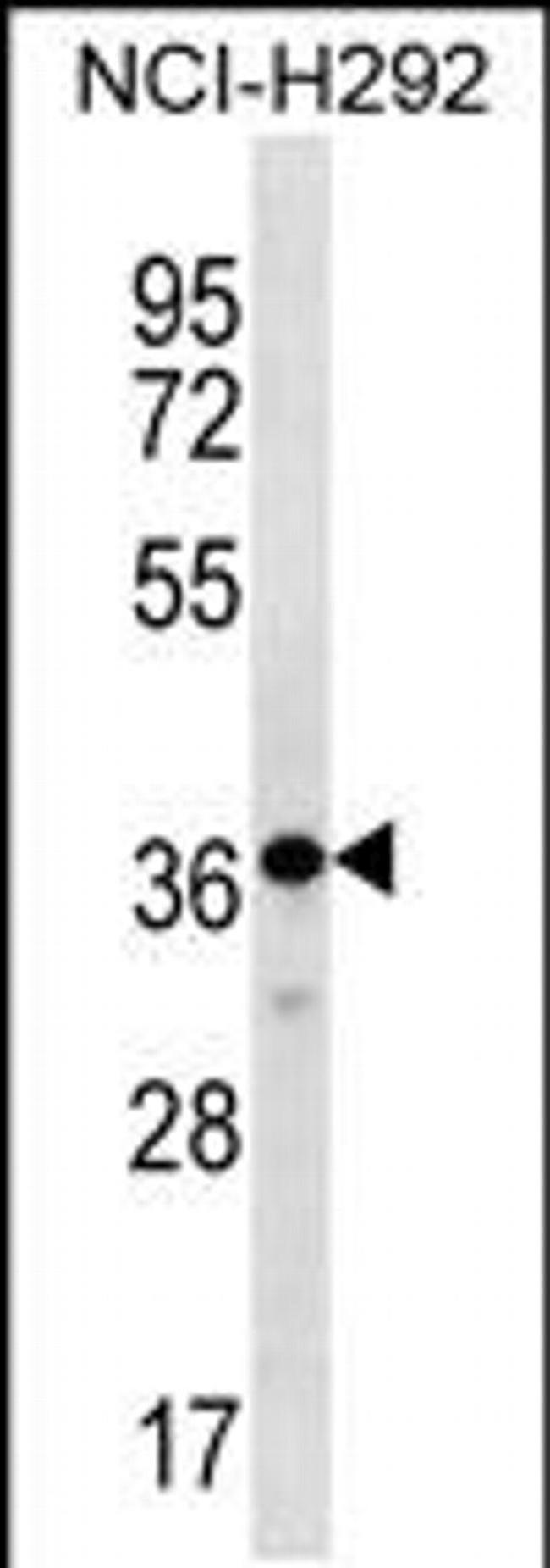 THAP8 Antibody in Western Blot (WB)