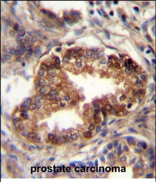 RAB3d Antibody in Immunohistochemistry (Paraffin) (IHC (P))