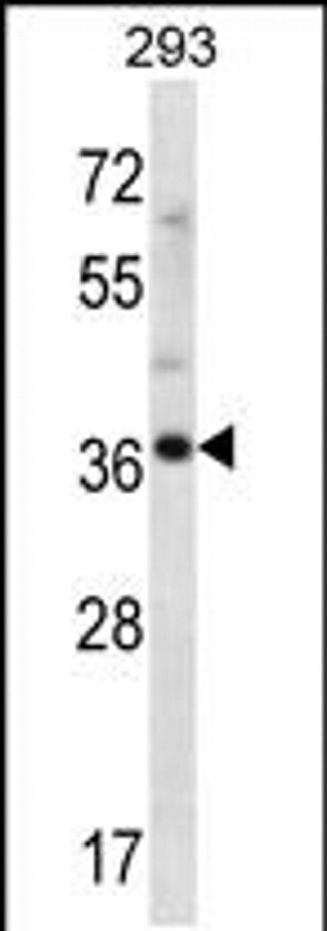 ANKRD60 Antibody in Western Blot (WB)