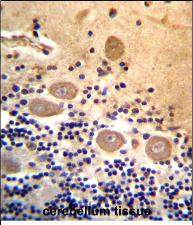 RTDR1 Antibody in Immunohistochemistry (Paraffin) (IHC (P))
