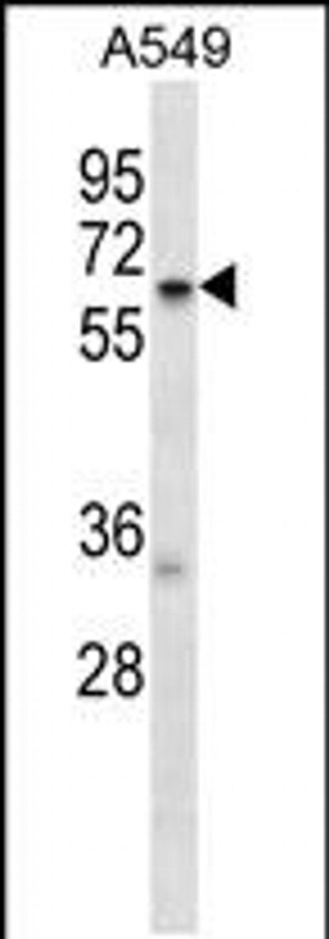 TCP11L2 Antibody in Western Blot (WB)