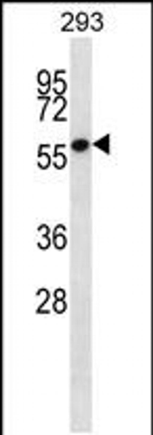 ZNF697 Antibody in Western Blot (WB)