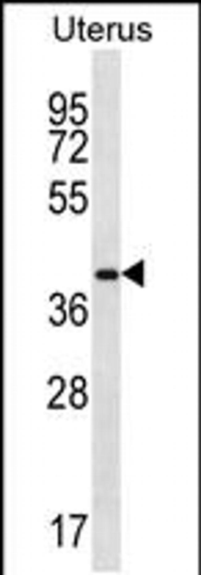 OR2V2 Antibody in Western Blot (WB)