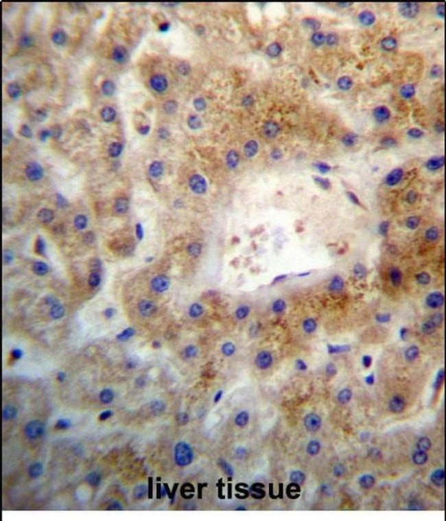 SGEF Antibody in Immunohistochemistry (Paraffin) (IHC (P))