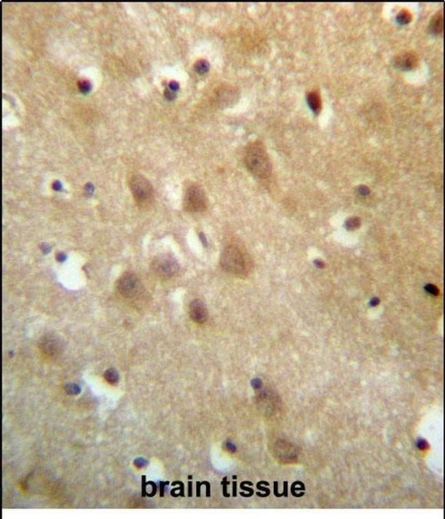 ZNF227 Antibody in Immunohistochemistry (Paraffin) (IHC (P))