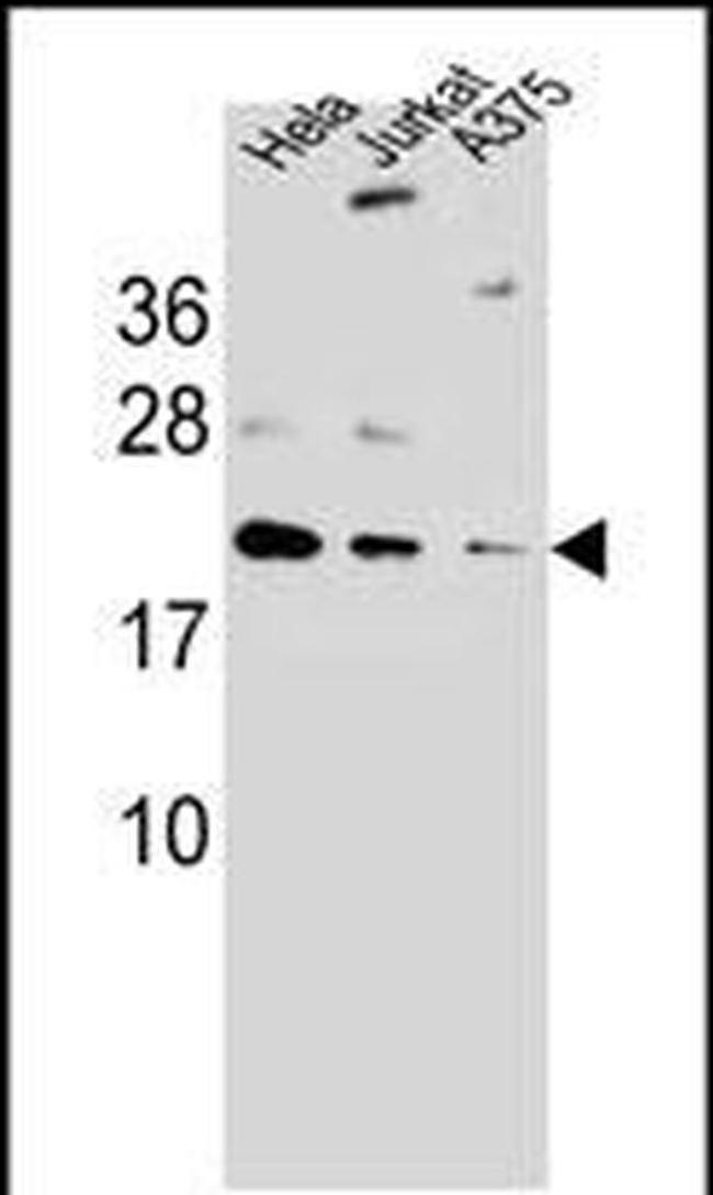 ARL6IP6 Antibody in Western Blot (WB)