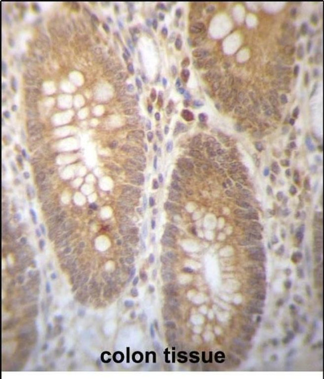 DHRS7B Antibody in Immunohistochemistry (Paraffin) (IHC (P))