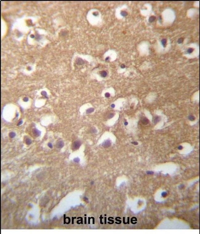 TMCC3 Antibody in Immunohistochemistry (Paraffin) (IHC (P))