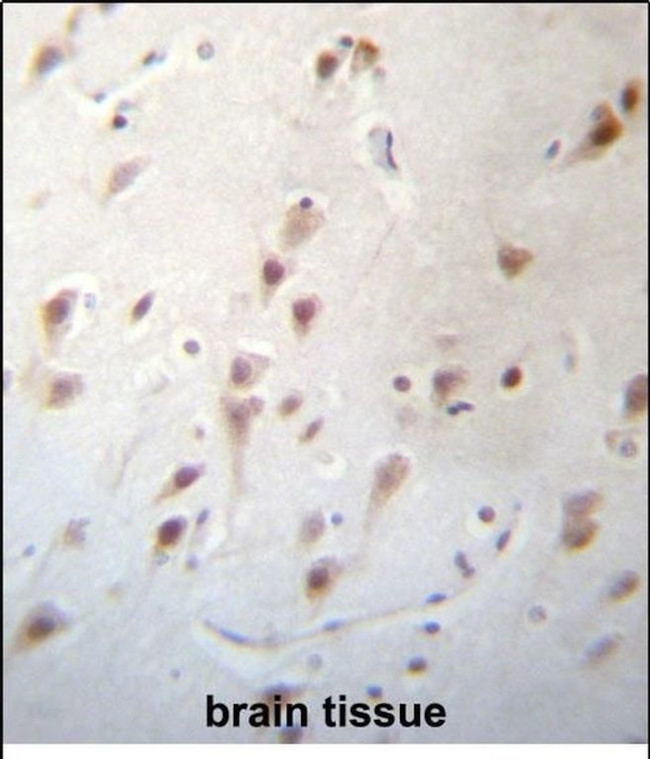 FOXJ3 Antibody in Immunohistochemistry (Paraffin) (IHC (P))