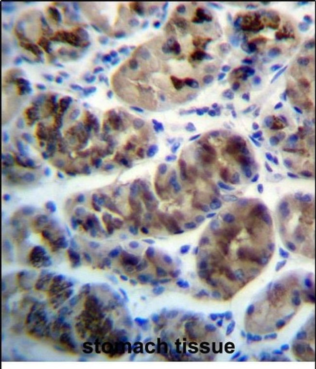 ZDHHC20 Antibody in Immunohistochemistry (Paraffin) (IHC (P))