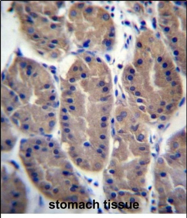 FRMD7 Antibody in Immunohistochemistry (Paraffin) (IHC (P))